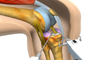 knee surgeon melbourne