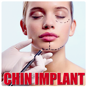Download Chin implant For PC Windows and Mac