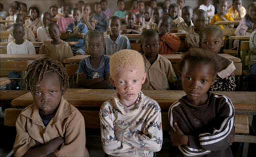 An albino child attends school in Tanzania. File photo.