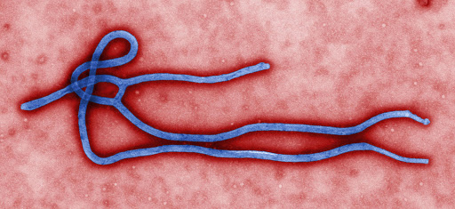 Ebola virus virion. Created by CDC microbiologist Cynthia Goldsmith, this colorized transmission electron micrograph (TEM) revealed some of the ultrastructural morphology displayed by an Ebola virus virion.