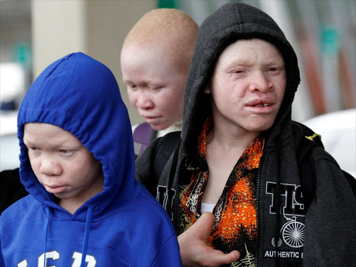 Mwigulu Magesa, Pendo Noni, and Emmanuel Rutema, (L-R) Tanzanian's with Albinism visiting the US for medical care, arrive at JFK International Airport in New York City, US, March 25, 2017. /REUTERS