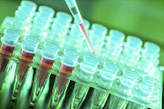 Laboratory research of cancer diseases, rack with RNA samples - Stock image