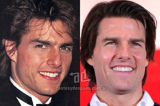 tom cruise teeth before after. Tom Cruise teeth, efore and