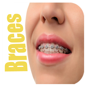 Download Braces Editor For PC Windows and Mac