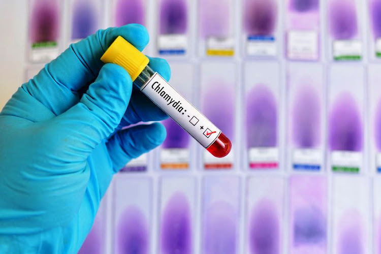 Chlamydia can be diagnosed with a blood test.