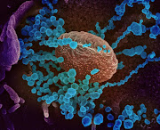 This scanning electron microscope image shows SARS-CoV-2, the virus that causes Covid-19, (round blue objects) emerging from the surface of cells cultured in the lab. SARS-CoV-2, also known as 2019-nCoV, is the virus that causes Covid-19. The virus shown was isolated from a patient in the US.  