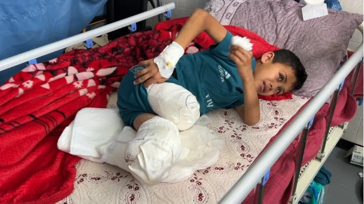 11-year-old Yassin al Ghalban lies in a hospital bed at the European Hospital in Rafah