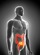 Colorectal cancer is spreading among black men too. /123RF