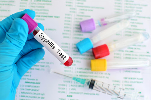 Types of tests for sexually transmitted infections include urine samples, blood tests, physical examination and cultures.
