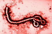 The ebola virus. (File photo)
