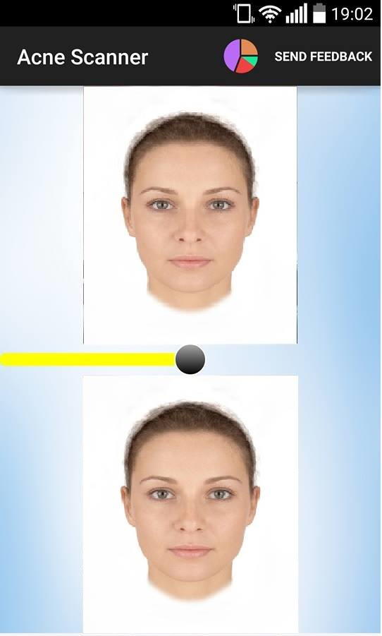 Android application Acne Scanner screenshort