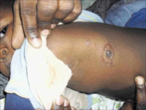 ATTENTION: One of Ndlovu's kids with a wound. Pic. Unknown.