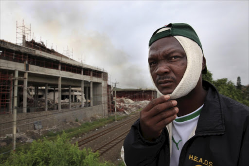 Brick layer Ntobeko Mzingithi who was injured when the Tongaat mall collapsed. Picture Credit: Gallo Images