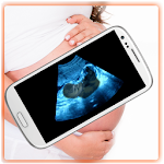 Ultrasound Scanner (Prank) Apk