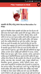 How to get Piles Treatment in Hindi 1.0.3 mod apk for laptop