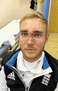 STUART BROAD