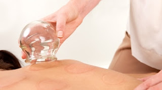 cupping therapy kinglake