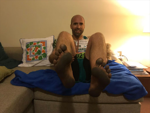 This is what Izak De Vries feet looked like after running the Comrades barefoot