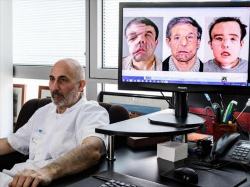 Prof Lantieri next to a screen showing the different steps of Mr Hamon's face. AGENCIES