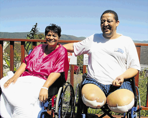 SIDE BY SIDE: 'God knew we were so close, he even took our legs at the same time,' says Maria Lakay of her and her husband Rodney's ordeal.
