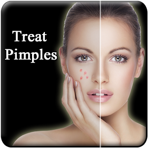 Download Pimple Remove in 7 Days For PC Windows and Mac