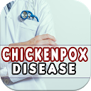 ダウンロード Chickenpox: Causes, Diagnosis, and Treatm をインストールする 最新 APK ダウンローダ