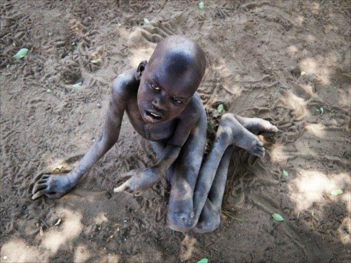 Patrick Anywar, 14, one of more than 3,000 children in northern Uganda who are suffering from a mystery ailment known as nodding disease, sits in the dust outside his family home in Tumangu village, in the northern Uganda Kitgum district.