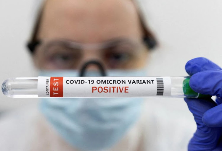 Test tube labelled 'Covic-19 Omicron variant test positive' is seen in this illustration picture taken January 15, 2022.