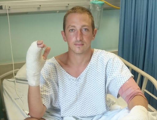 Shark attack victim Mathieu Dasnois, who was injured in his legs and arms, was treated at St Mary's private hospital in Mthatha. Picture: LOYISO MPALANTSHANE