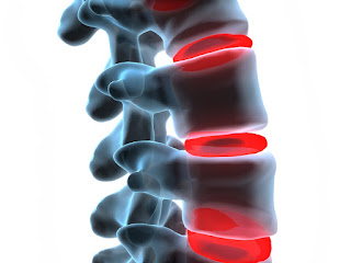 spinal reconstructive surgery
