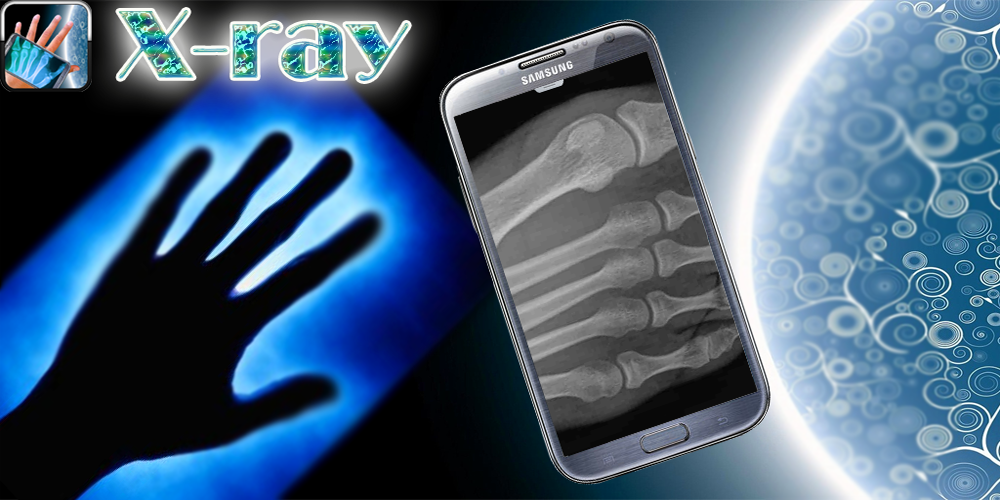 Android application X-Ray Scanner Joke screenshort