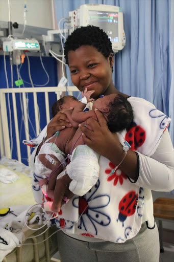 Conjoined twins, Uwenzile and Uyihlelile Shilongonyane born joined at the abdomen on 2 January this year, with their mother 19-year-old Bongekile Simelane, minutes before they underwent their separation surgery at Netcare Unitas Hospital in Centurion. Picture supplied by Netcare.