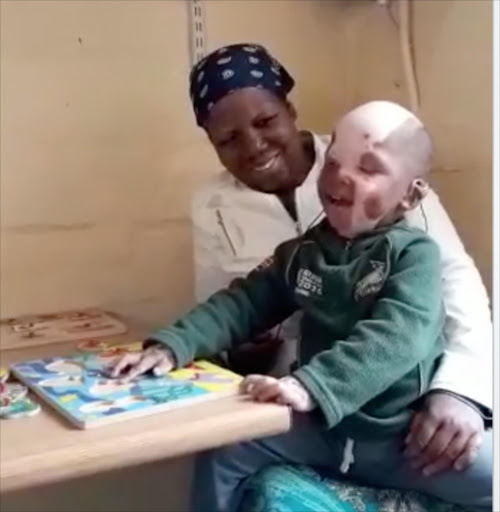 Two- year-old Imbo Fufu hears sound for the first time after his cochlear implant was switched on.