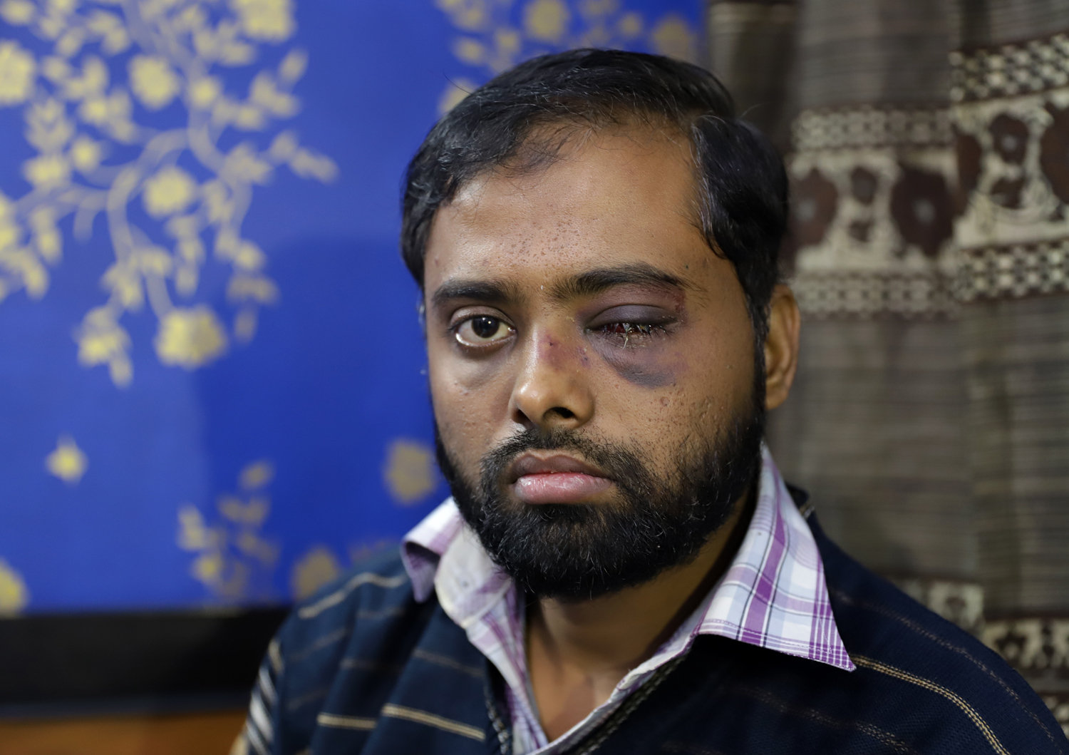 There is fear, but I will not lose hope: Jamia student who lost an eye during an attack by Delhi Police