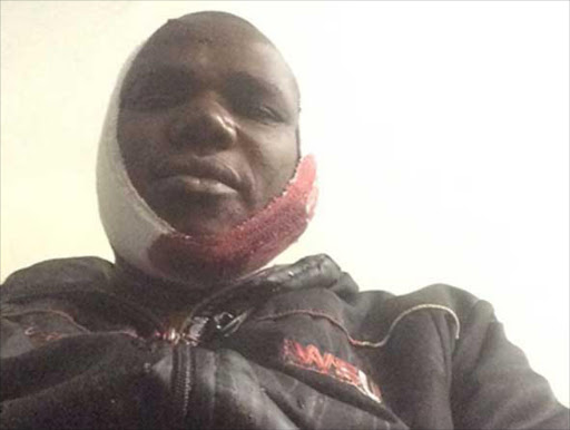 WSU Sasco member Mzingisi Faku was allegedly attacked by members of the ANCYL Picture: SUPLIED