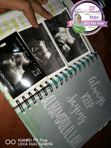 Set Kecutkan Fibroid Shaklee, Shaklee Kecutkan Fibroid, Shaklee Untuk Kecutkan Fibroid,