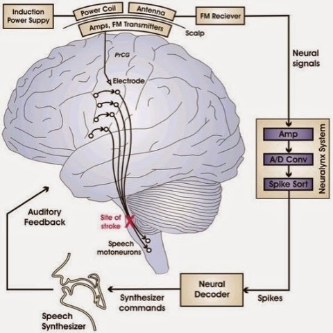 Sindrome De Enclaustramiento