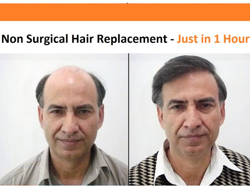 Passion Hair Plus Hair Weaving Non Surgical Hair Replacement