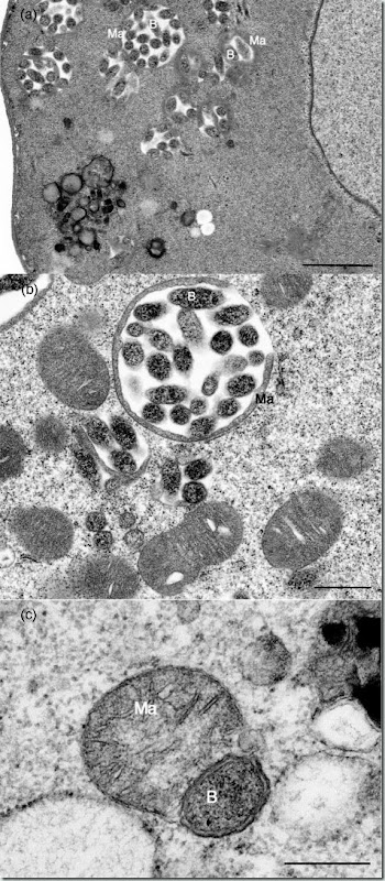 Midichloria mitochondrii