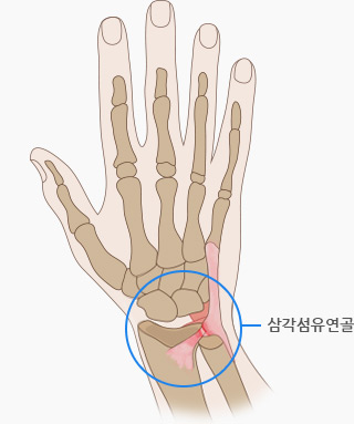 파일:external/ysks.co.kr/triangular_hand.jpg