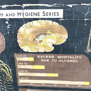 Vintage Denoyer Geppert Anatomy Chart #2