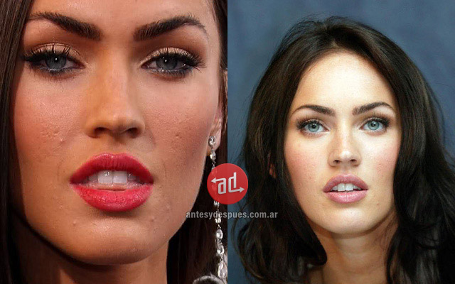 Photos of Megan Fox with acne