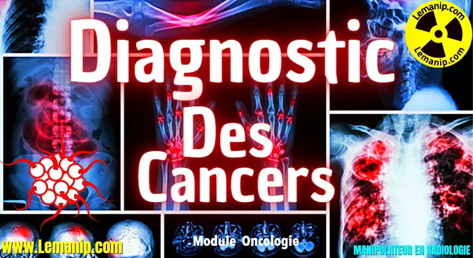 Diagnostic Du Cancer