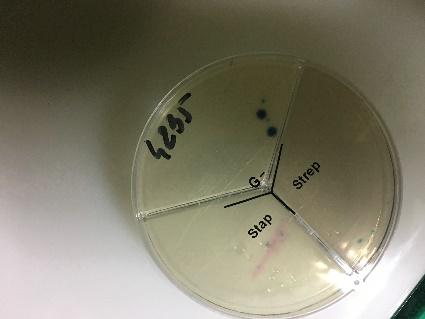 C:\Sławek\PM TEST\G(-)\klebsiella pneumoniae\IMG_0239.JPG