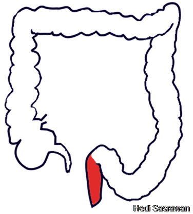 Lokasi rektum dalam usus besar (warna merah)