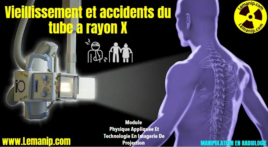 Vieillissement et accidents du tube a rayon X