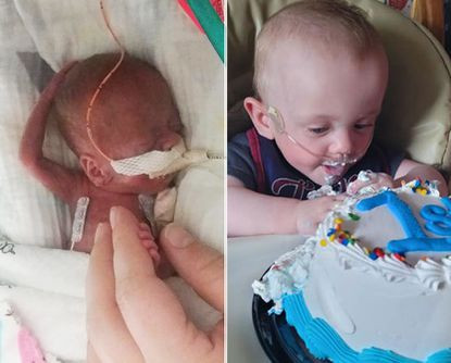 World's most premature baby born at 5 months celebrates his first birthday despite having 0% odds of surviving