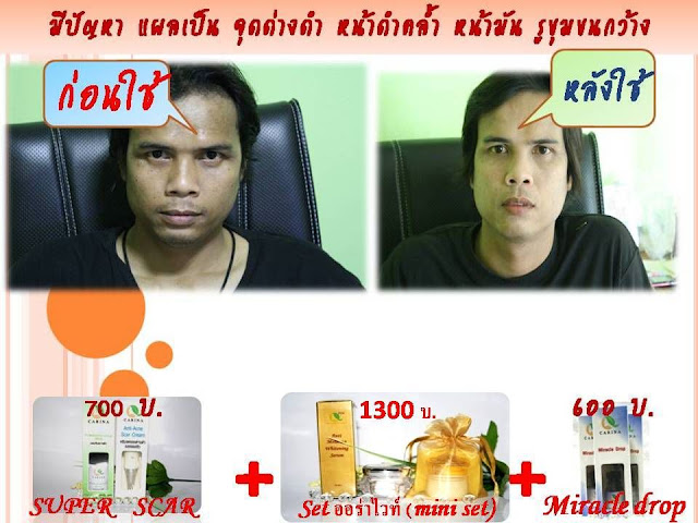 รีแพร์ repair กระชับชิมิ ชิมิหลวม ทำสาว โดยไม่ต้องทำ  รีแพร์ แถมปัญหา ดำ คล้ำ มีกลิ่น  ของท่านหญิงจะหมดไป เมื่อได้สัมผัสกับ Lady Lifting Serum    %2525E0%2525B8%2525A0%2525E0%2525B8%2525B2%2525E0%2525B8%25259E%2525E0%2525B8%252599%2525E0%2525B8%2525B4%2525E0%2525B9%252588%2525E0%2525B8%2525873