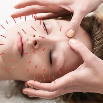 Dr. Diane B Sandler Acupuncture and Craniosacral