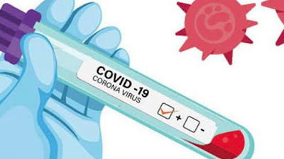 Langsa Akan Lakukan Rapid Test Massal Covid-19